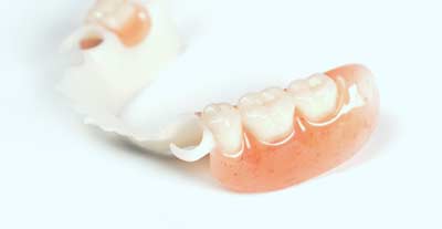 Acetal Partial at Alpine Denture Center
