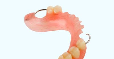Acrylic Partial at Alpine Denture Center